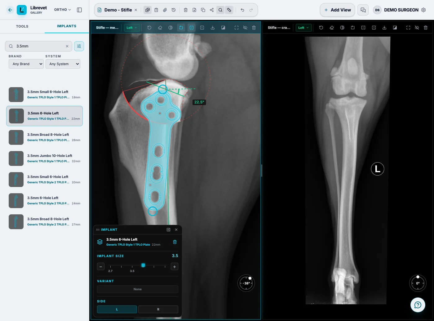 Librevet's Implants tab searching 3.5 mm plates, with generic TPLO plates listed from small to jumbo, and the selected six-hole plate placed at true scale on a left tibia, its floating panel offering the other sizes and sides, beside the craniocaudal view.