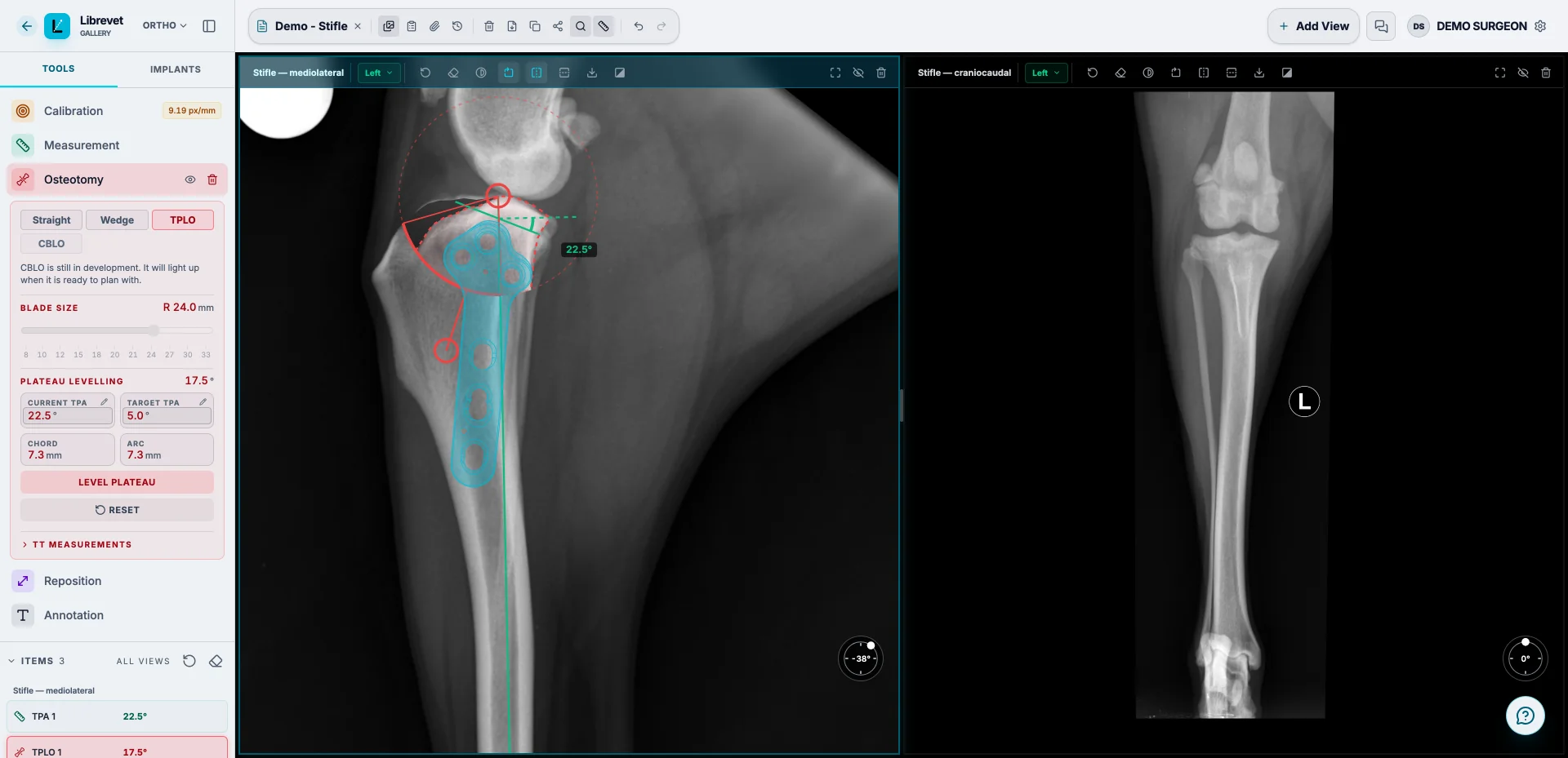 Librevet planning a TPLO on a left tibia: the tibial plateau angle measured at 22.5 degrees, a 24 mm osteotomy levelled to a target of 5 degrees, and a 3.5 mm TPLO plate overlaid at true scale, with the craniocaudal view alongside.